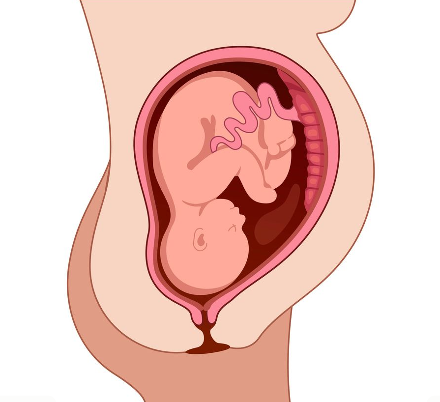 Estructural obstétrico